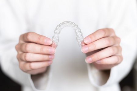 Ką svarbu žinoti prieš pradedant dantų tiesinimą kapomis?